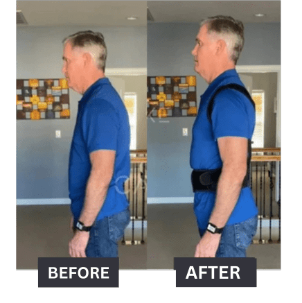 UpRight™ Posture Corrector